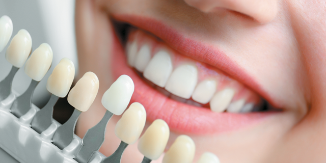 Dental Crowns and Bridges Treatment in Yerwada