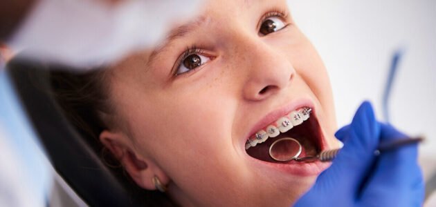The Right “Braces” For Your Child