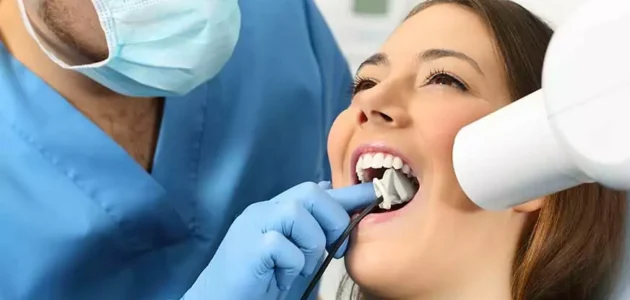 Root Canal Treatment in Koregaon Park